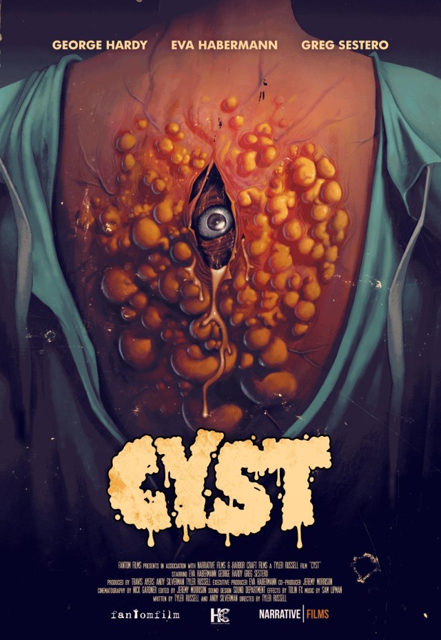 Cyst ( 2020 )